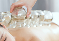 Fredericton-Acupuncture-Cupping
